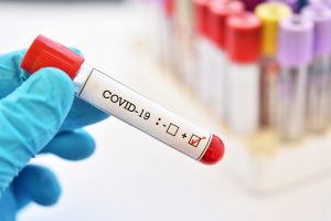 coronavirus-positive1